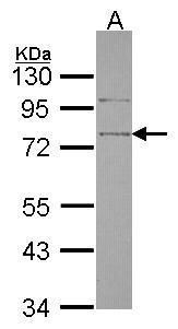 SRPX Rabbit Polyclonal Antibody