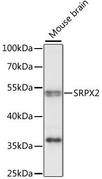 SRPX2 antibody
