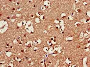 SRR Antibody