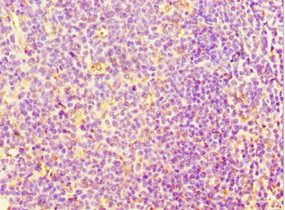 SRRT Antibody