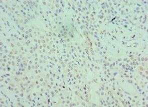 SRSF1 Antibody