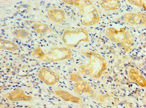 SRSF4 Antibody