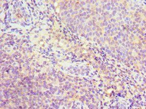 SRSF4 Antibody