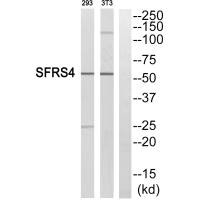 SRSF4 antibody