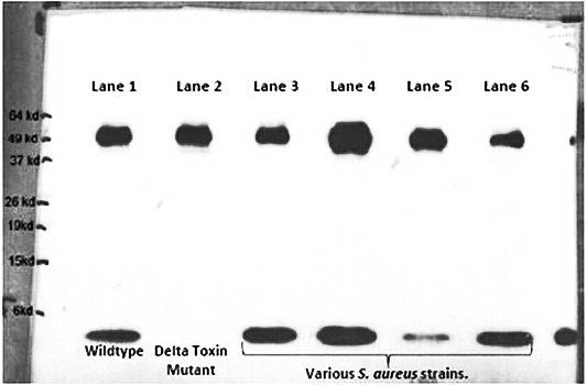 S. Aureus Delta Hemolysin antibody
