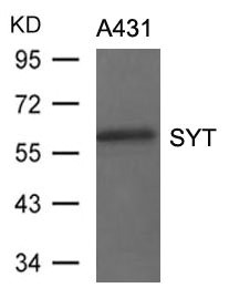 SS18 antibody