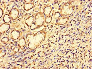 SS18L1 Antibody