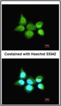 SSA1 antibody