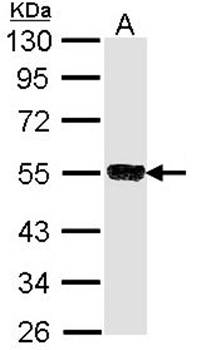 SSA1 antibody