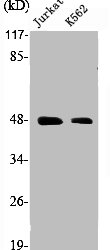 SSB antibody