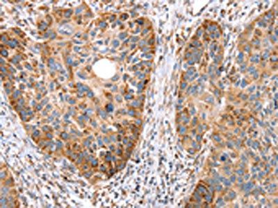 SSBP1 Antibody