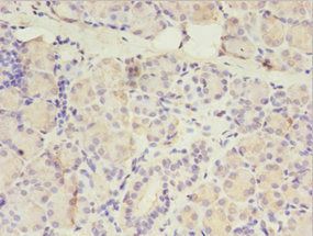 ITPRID2 Antibody