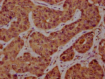 SSH1 Antibody