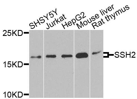 SSH2 antibody