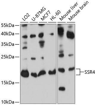 SSR4 antibody