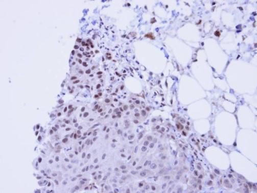 SSRP1 antibody [N1N3]