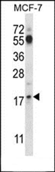 SSSCA1 antibody