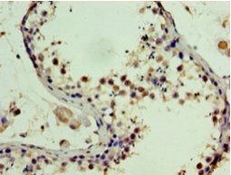 SSSCA1 Antibody