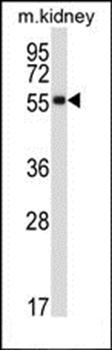 SSTR1 antibody