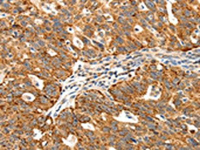 SSTR1 Antibody