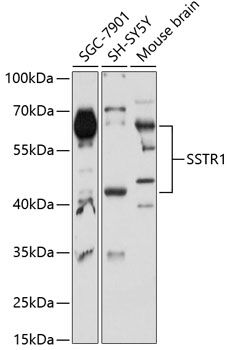 SSTR1 antibody