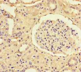 SSTR2 antibody