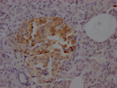 SSTR2 Recombinant Monoclonal Antibody