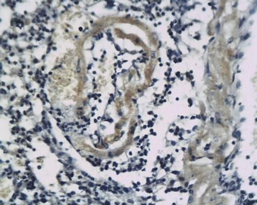 Somatostatin Receptor 2 Rabbit Polyclonal Antibody