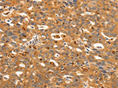 SSTR3 Antibody