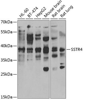 SSTR4 antibody