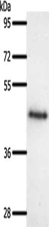 SSTR5 antibody