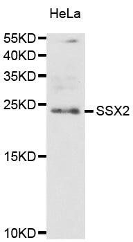 SSX2 antibody