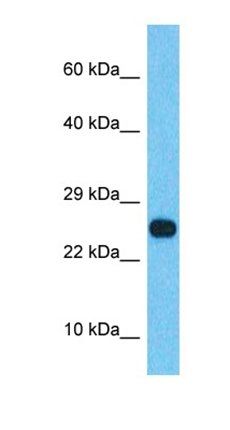 SSX2B antibody
