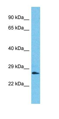 SSX2B antibody