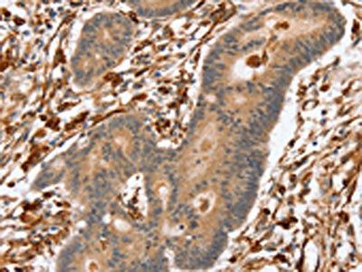 SSX2IP antibody