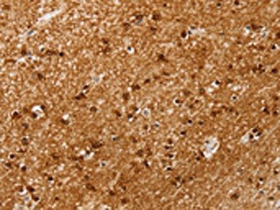 SSX4 Antibody