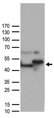 ST13 antibody