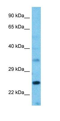 ST1A2 antibody