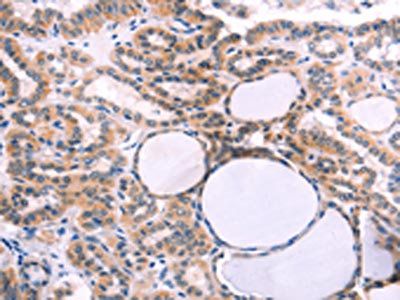 IL1RL1 Antibody