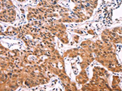 IL1RL1 Antibody
