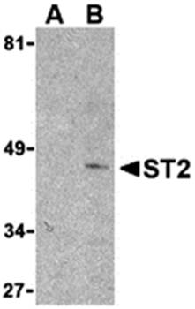 ST2 Antibody