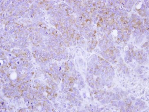 ST3GAL2 Rabbit Polyclonal Antibody