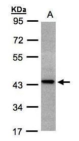 ST3GAL2 Rabbit Polyclonal Antibody