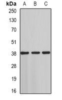 ST3GAL4 antibody