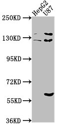 ST5 antibody