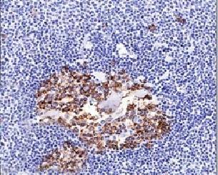 ST6GAL1 Antibody