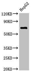 ST6GALNAC1 antibody