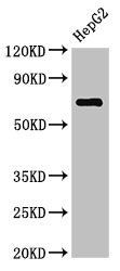 ST6GALNAC1 Antibody