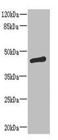 ST6GALNAC2 Antibody