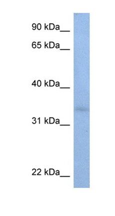 ST6GALNAC3 antibody